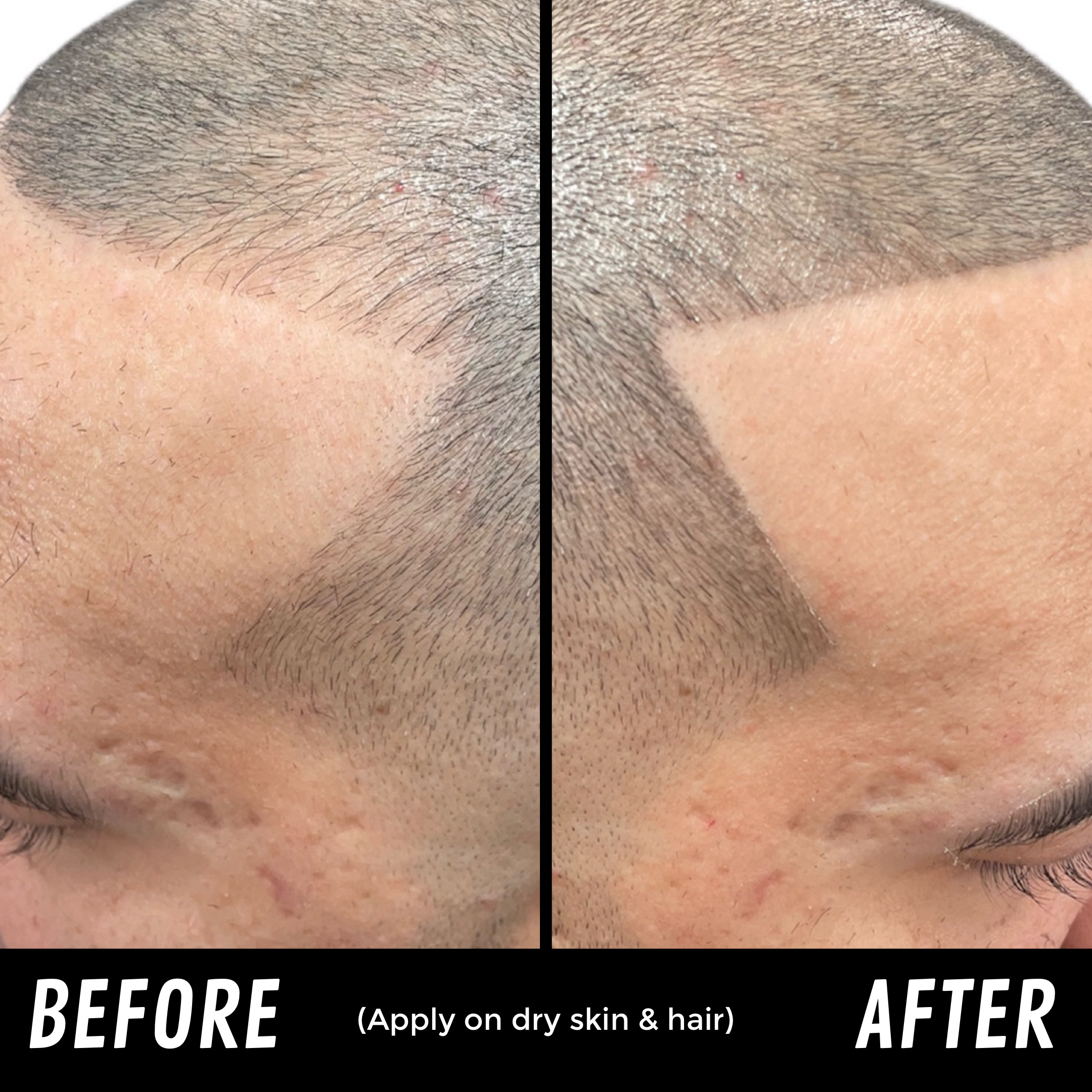 Before and after on short hair.