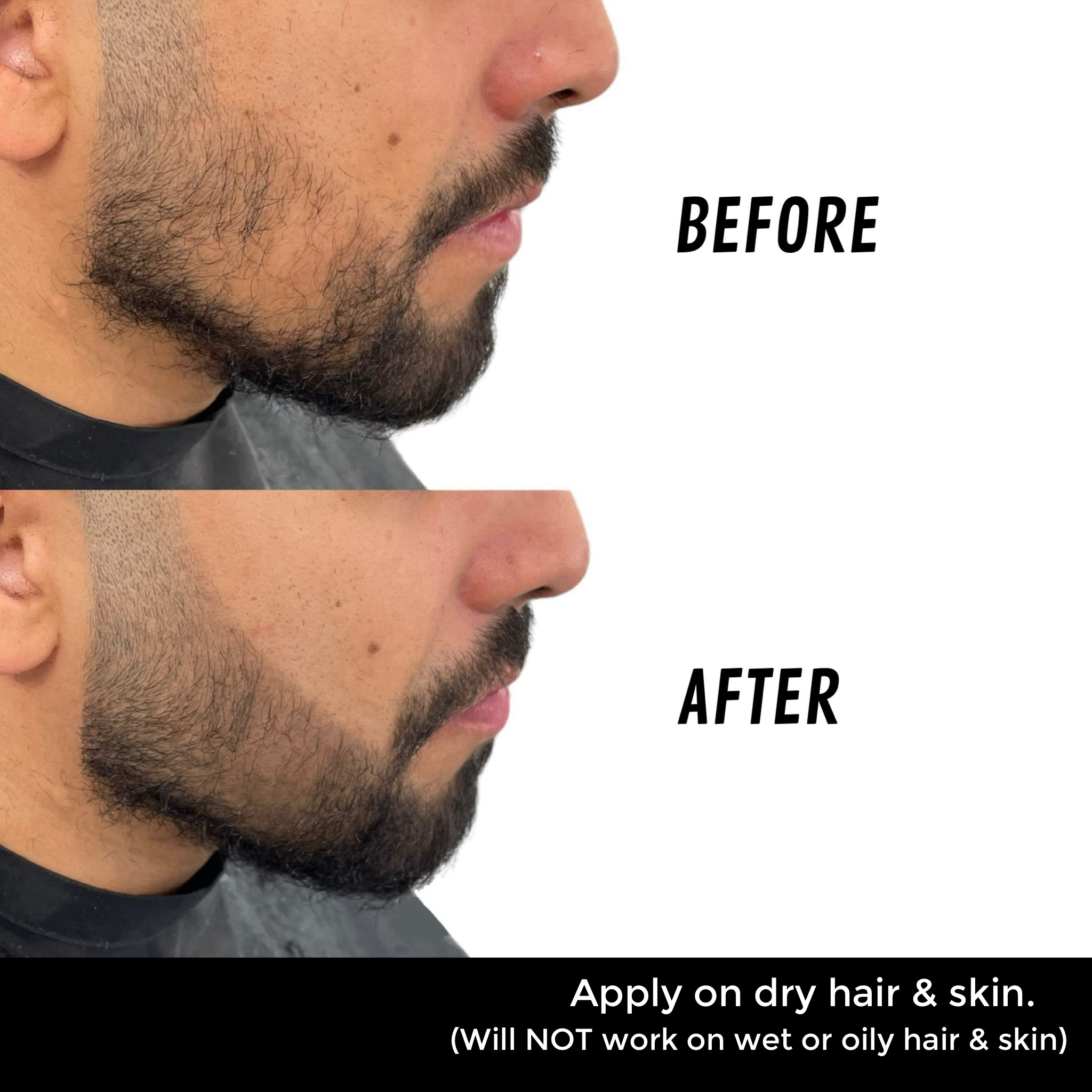 Before and after on a beard line.